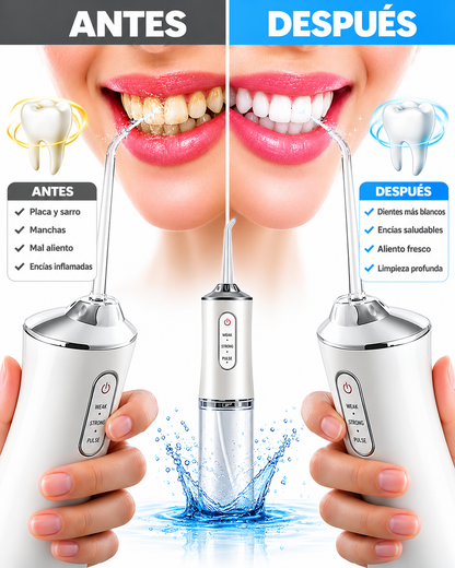 IRRIGADOR DENTAL PRO
